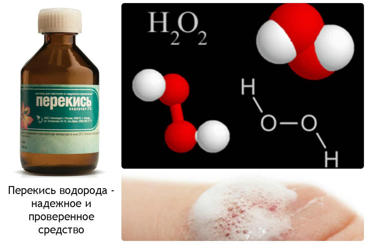 О способах и методиках очистки воды из скважины